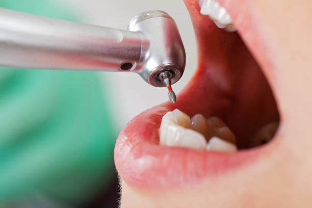 Best Emergency Treatment for Toothache in Augusta, KS